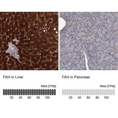 Immunohistochemistry-Paraffin: Fumarylacetoacetate hydrolase Antibody [NBP2-48736]