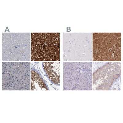 Immunohistochemistry-Paraffin: Fumarylacetoacetate hydrolase Antibody [NBP2-48736]