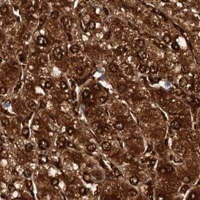 Immunohistochemistry-Paraffin: Fumarylacetoacetate hydrolase Antibody [NBP2-48736]