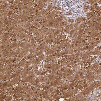 Immunohistochemistry-Paraffin: Fumarylacetoacetate hydrolase Antibody [NBP2-48807]