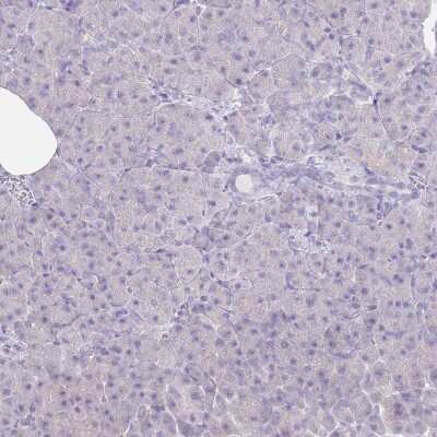 Immunohistochemistry-Paraffin: Fumarylacetoacetate hydrolase Antibody [NBP2-48807]