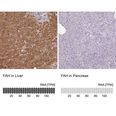 Immunohistochemistry-Paraffin: Fumarylacetoacetate hydrolase Antibody [NBP2-48807]