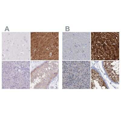 Immunohistochemistry-Paraffin: Fumarylacetoacetate hydrolase Antibody [NBP2-48807]