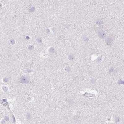 Immunohistochemistry-Paraffin: Fumarylacetoacetate hydrolase Antibody [NBP2-48807]