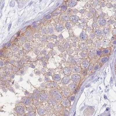 Immunohistochemistry-Paraffin: Fumarylacetoacetate hydrolase Antibody [NBP2-48807]