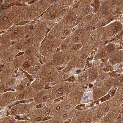 Immunohistochemistry-Paraffin: Fumarylacetoacetate hydrolase Antibody [NBP2-48807]