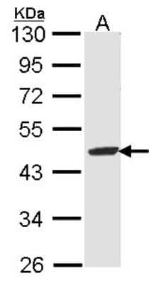 Western Blot: Fumarylacetoacetate hydrolase Antibody [NBP1-33662]