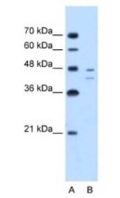 Western Blot: Fumarylacetoacetate hydrolase Antibody [NBP1-53110]