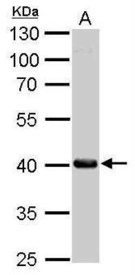 Western Blot: Fumarylacetoacetate hydrolase Antibody [NBP2-16546]