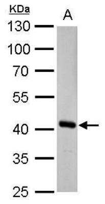 Western Blot: Fumarylacetoacetate hydrolase Antibody [NBP2-16546]