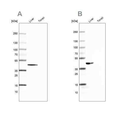 Western Blot: Fumarylacetoacetate hydrolase Antibody [NBP2-48736]