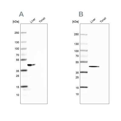 Western Blot: Fumarylacetoacetate hydrolase Antibody [NBP2-48807]