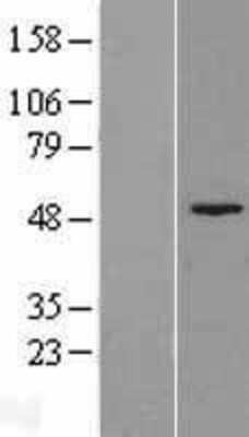 Western Blot: Fumarylacetoacetate hydrolase Overexpression Lysate [NBL1-10428]