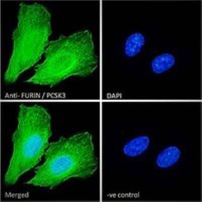 Immunocytochemistry/ Immunofluorescence: Furin Antibody [NBP2-26104]