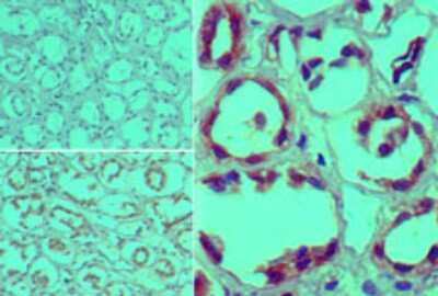 Immunohistochemistry-Paraffin: Furin Antibody [NBP2-24687]