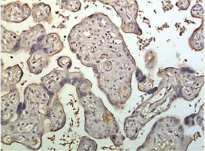 Immunohistochemistry-Paraffin: Furin Antibody (MM0298-4G31) - Azide and BSA Free [NBP2-12321]