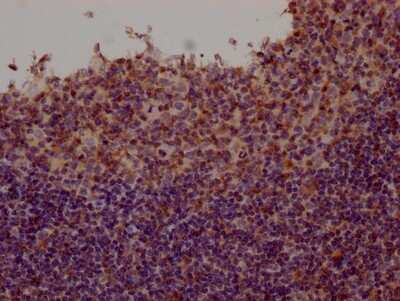 Immunohistochemistry: Fyn Antibody (1G3) [NBP3-15159]