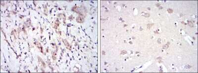 Immunohistochemistry: Fyn Antibody (2A10) - BSA Free [NBP2-37588]