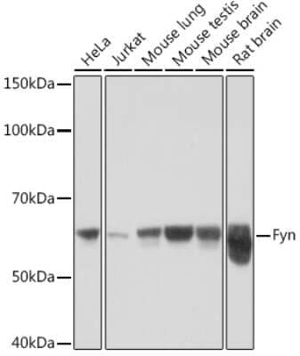 Western Blot: Fyn Antibody (7Z9F2) [NBP3-16773]