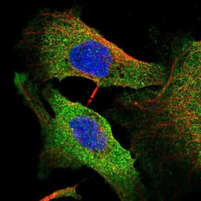 Immunocytochemistry/ Immunofluorescence: Fyn Antibody [NBP2-57212]