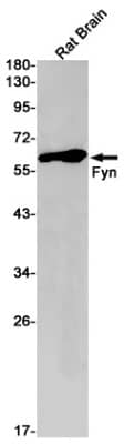 Western Blot: Fyn Antibody (S07-9I2) [NBP3-19641]