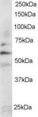 Western Blot: Fyn Antibody [NB300-928]