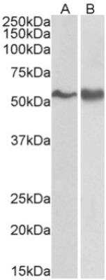 Western Blot: Fyn Antibody [NB300-928]