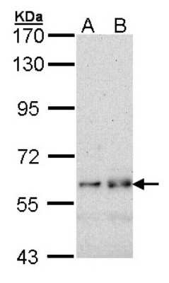 Western Blot: Fyn Antibody [NBP1-32067]