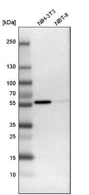 Western Blot: Fyn Antibody [NBP1-82685]