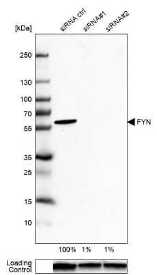 Western Blot: Fyn Antibody [NBP1-82685]