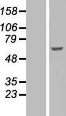 Western Blot: Fyn Overexpression Lysate [NBL1-10885]