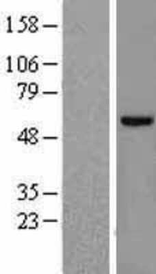 Western Blot: Fyn Overexpression Lysate [NBL1-10887]