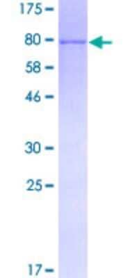 SDS-PAGE: Recombinant Human Fyn GST (N-Term) Protein [H00002534-P01]