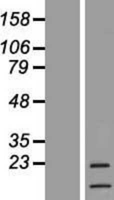 Western Blot: G-CSF Overexpression Lysate [NBL1-09518]