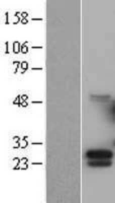 Western Blot: G-CSF Overexpression Lysate [NBL1-09519]