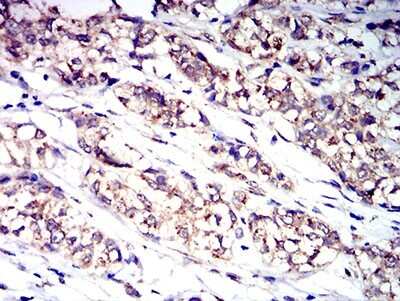 Immunohistochemistry: G-CSFR/CD114 Antibody (8F8B12) - BSA Free [NBP2-61696]