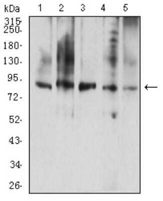 Western Blot: G-CSFR/CD114 Antibody (8F8B12)BSA Free [NBP2-61696]