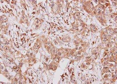 Immunohistochemistry-Paraffin: G-CSFR/CD114 Antibody [NBP2-16629]