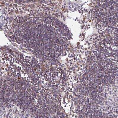 Immunohistochemistry-Paraffin: G-CSFR/CD114 Antibody [NBP2-33513]