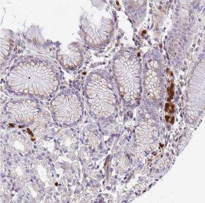 Immunohistochemistry-Paraffin: G-CSFR/CD114 Antibody [NBP2-33513]