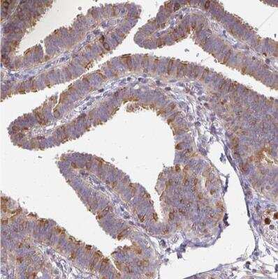 Immunohistochemistry-Paraffin: G-CSFR/CD114 Antibody [NBP2-33513]