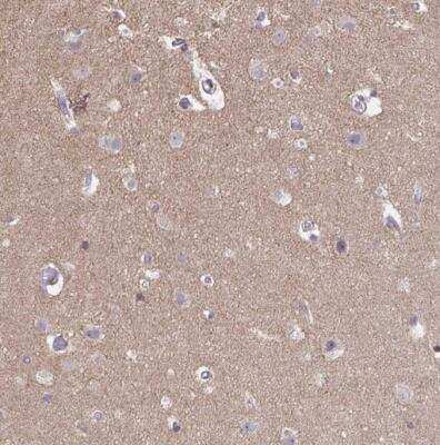 Immunohistochemistry-Paraffin: G-CSFR/CD114 Antibody [NBP2-33513]