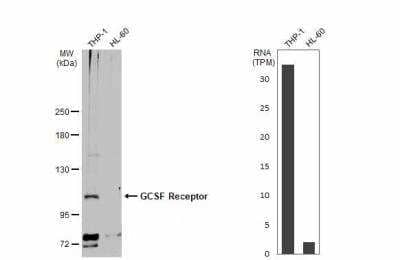 Western Blot: G-CSFR/CD114 Antibody [NBP2-16629]