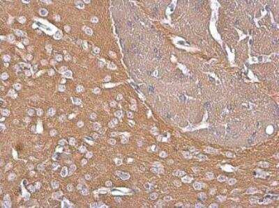 Immunohistochemistry-Paraffin: G Protein alpha z Antibody [NBP1-31604]