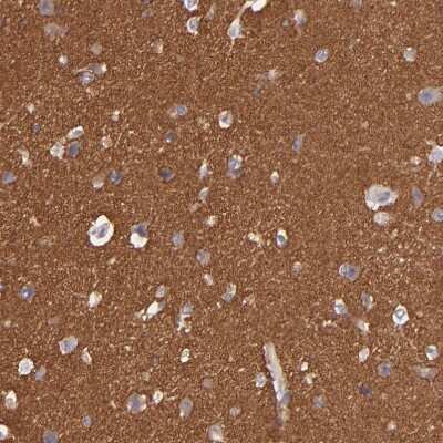 Immunohistochemistry-Paraffin: G Protein alpha z Antibody [NBP1-88111]