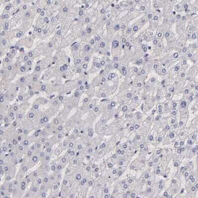 Immunohistochemistry-Paraffin: G Protein alpha z Antibody [NBP1-88111]