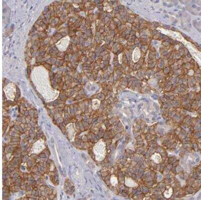 Immunohistochemistry-Paraffin: G Protein alpha z Antibody [NBP1-88111]