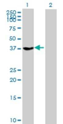 Western Blot: G Protein alpha z Antibody [H00002781-B01P]