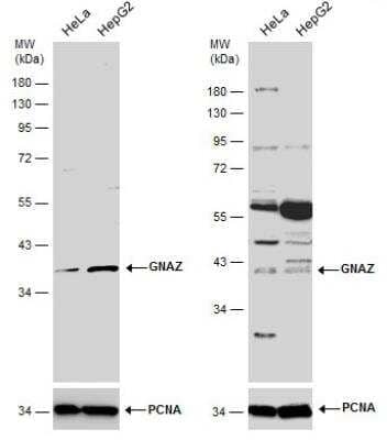 Western Blot: G Protein alpha z Antibody [NBP1-31604]