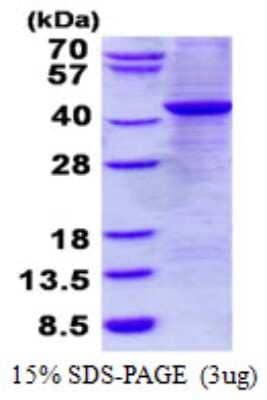 SDS-PAGE: Recombinant Human G Protein alpha z His Protein [NBP2-23095]